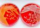 Infecții stafilococice și streptococice hemolitice