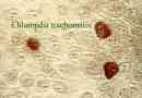 Chlamydia: perioada de incubație, simptome, tratament
