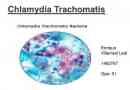 Chlamydia trachomatis chlamydia trachomatis la femei