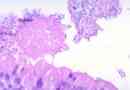Clostridium perfringens: descriere, proprietăți biologice, simptome