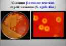 Streptococcus agalactia în frotiu sau urină la bărbați și femei